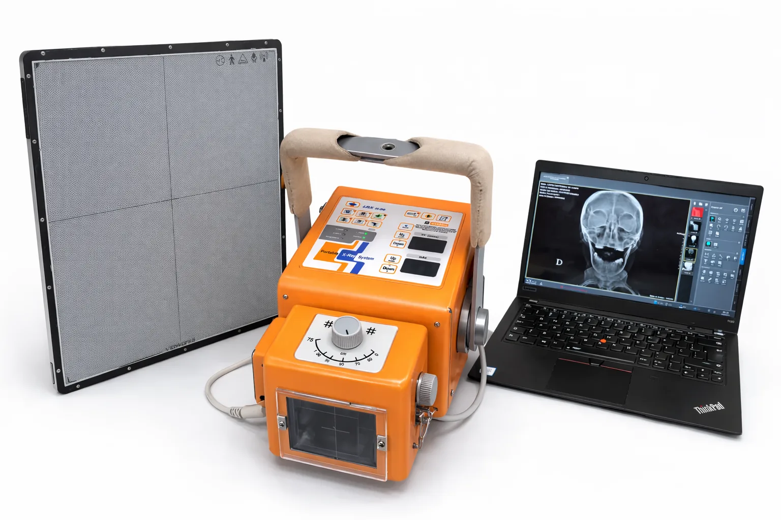 Equipamento portátil de raio-X digital com detector e notebook